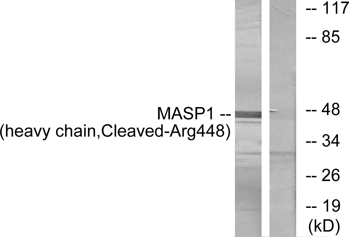 MASP1 heavy chain Ab