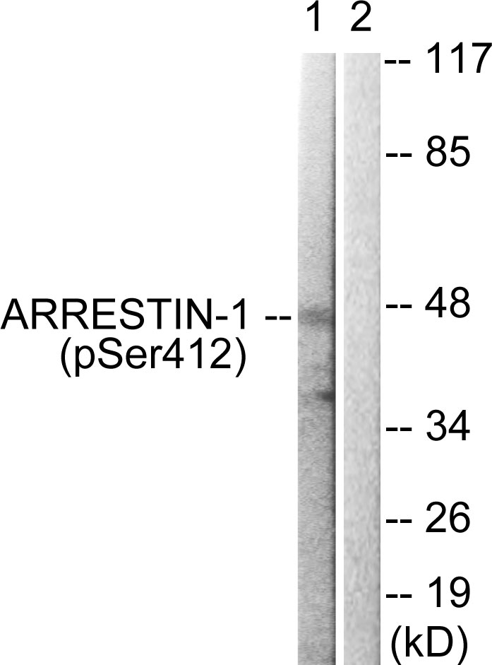 p-beta Arrestin 1 (S412) Ab