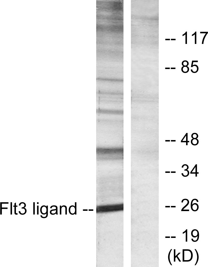 Flt3 ligand Ab