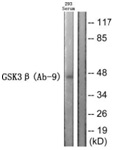 GSK 3 beta Ab