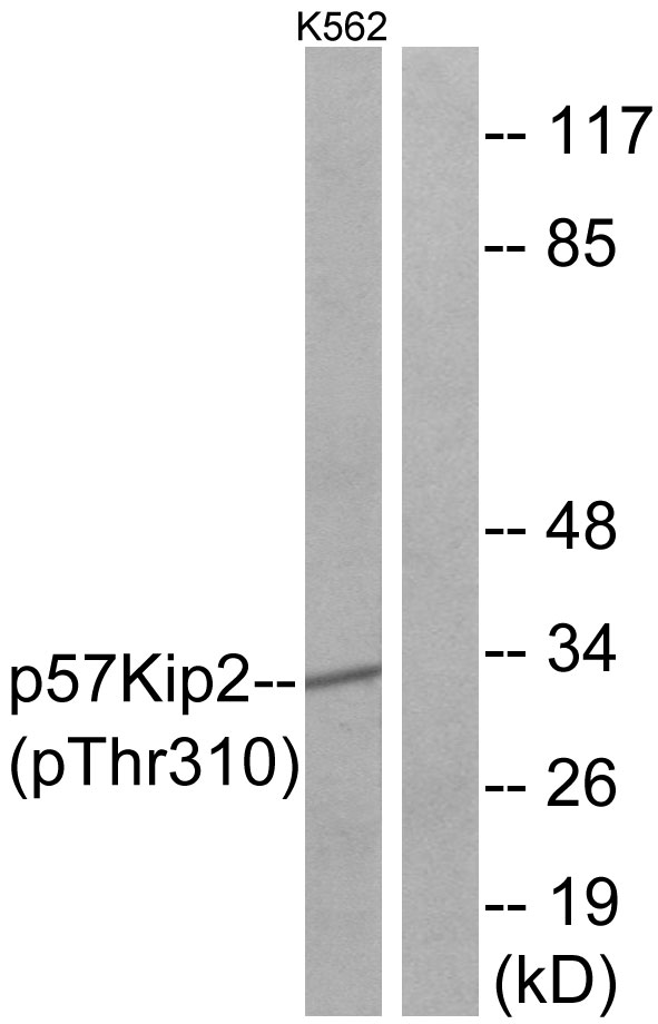 p-p57 Kip2 (T310) Ab