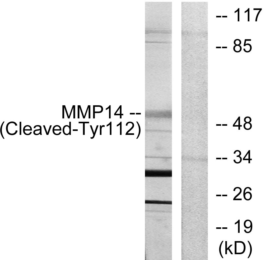 Cleaved-MMP14 (Y112) Ab