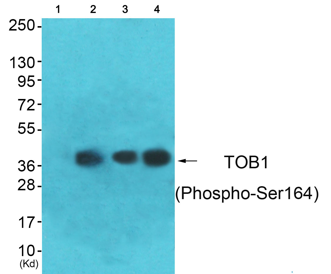 p-TOB1 (S164) Ab