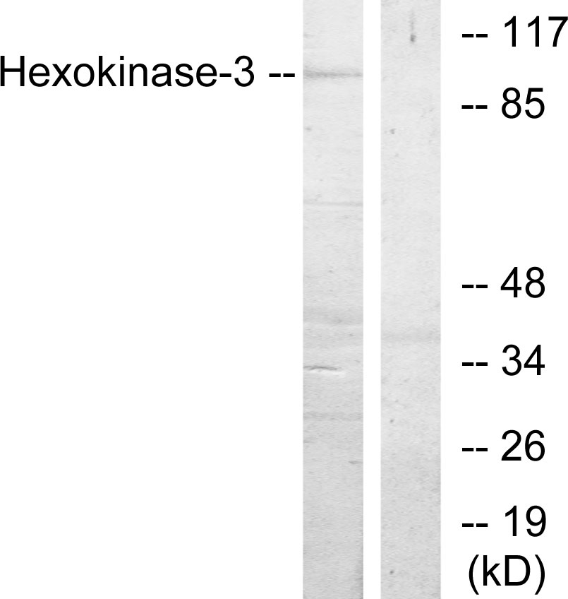 Hexokinase 3 Ab