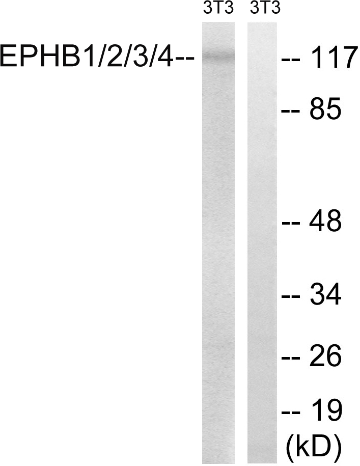 EPHB1/2/3/4 Ab