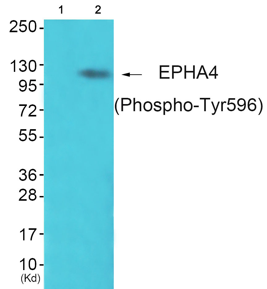 p-EPHA4 (Y596) Ab