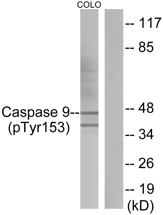 p-Caspase 9 (Y153) Ab