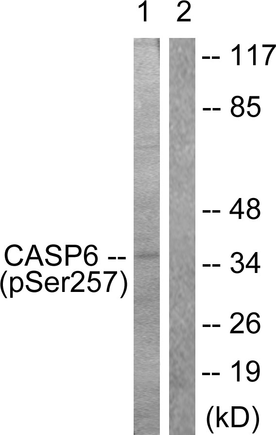 p-Caspase 6 (S257) Ab