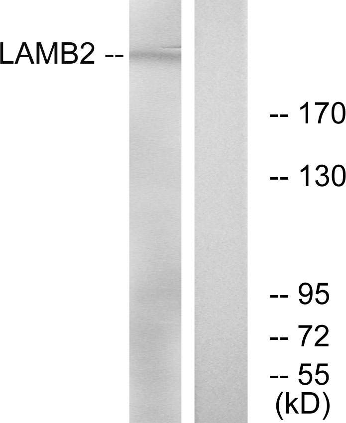 Laminin beta 2 Ab