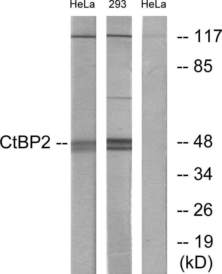 CtBP2 Ab