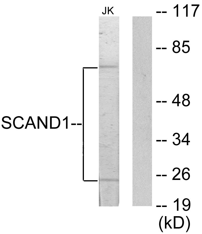 SCAND1 Ab