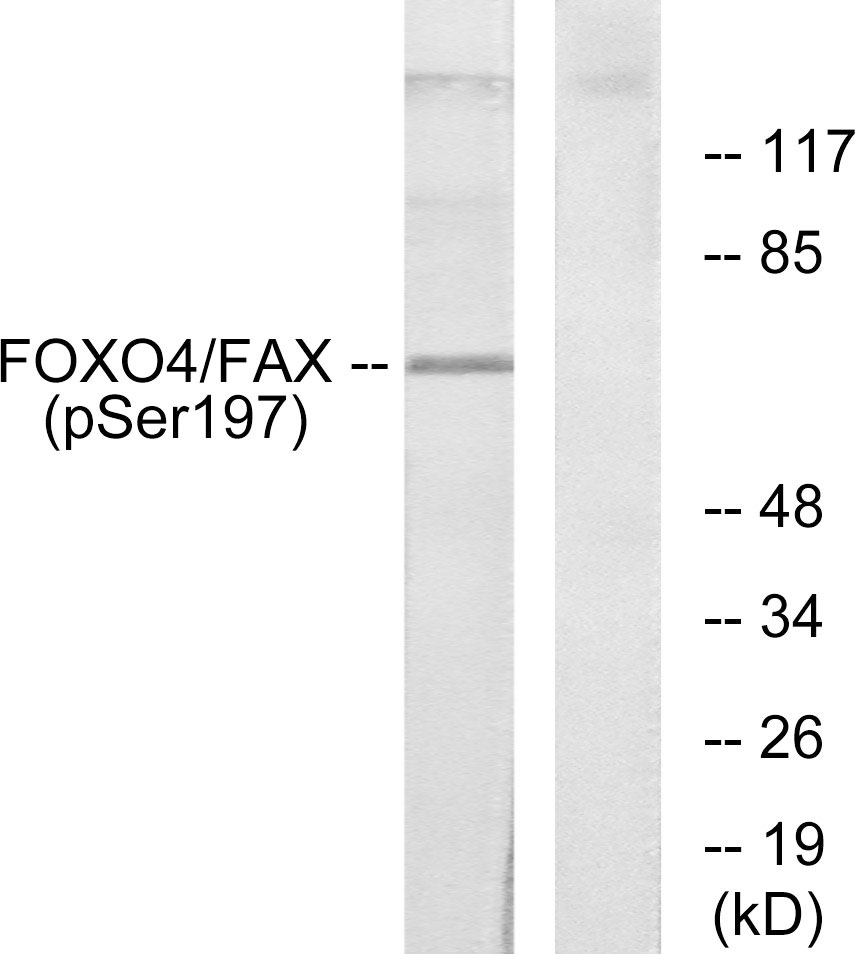 p-FOXO4 (S197) Ab