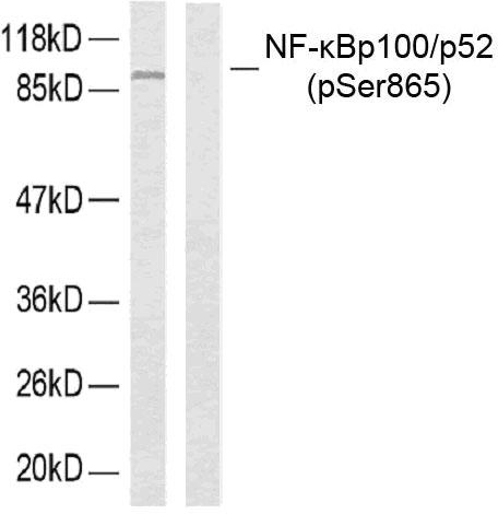 p-NF-kB p52 (S866) Ab