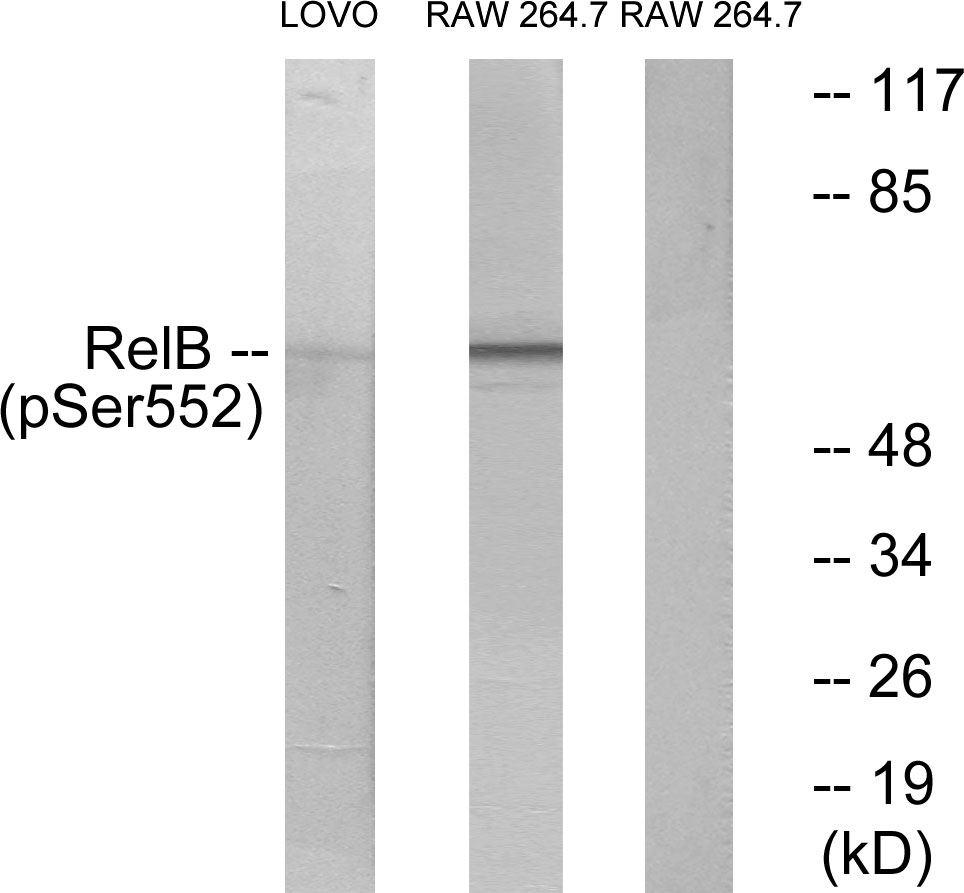 p-RelB (S573) Ab