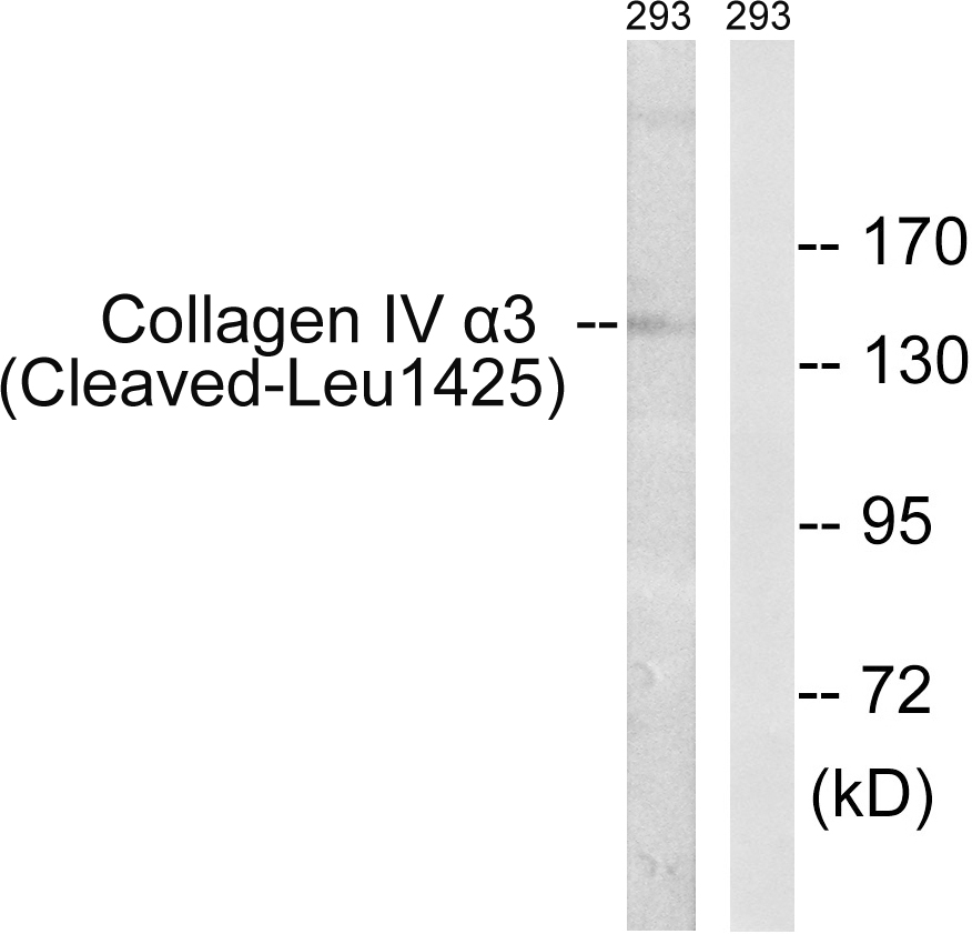 Collagen IV alpha 3 Ab