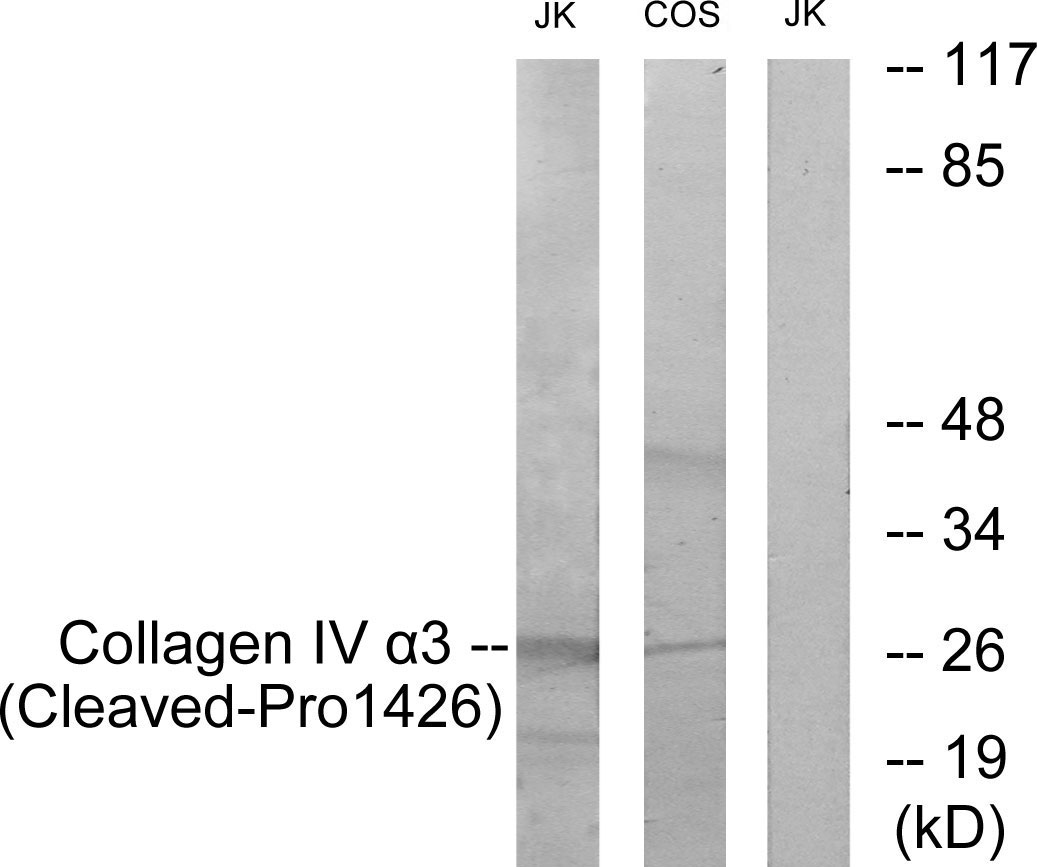 Collagen IV alpha 3 Ab