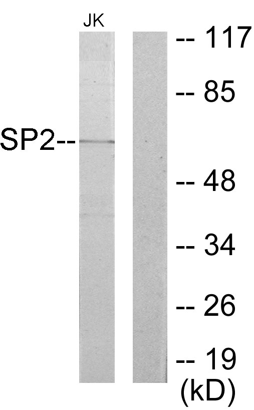 SP2 Ab