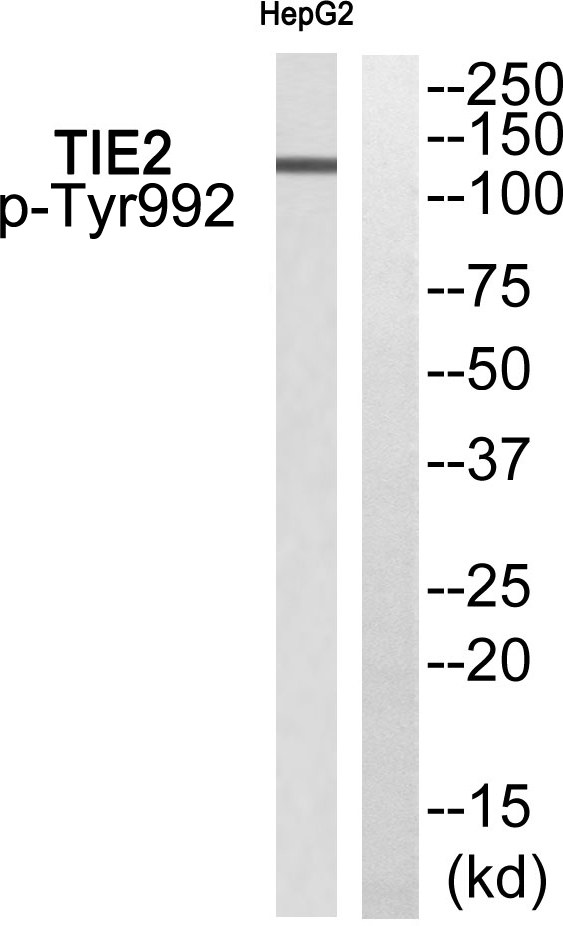 p-Angiopoietin 1 receptor (Y992) Ab