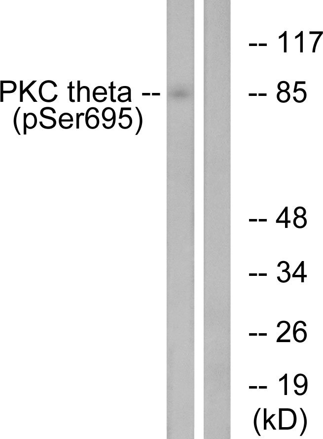 p-PKC theta (S676) Ab