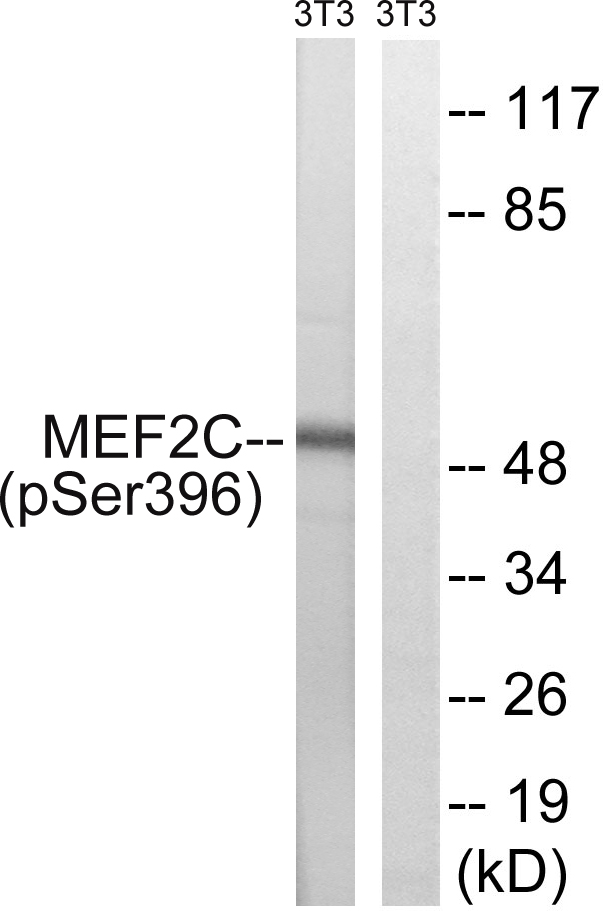 p-MEF2C (S396) Ab