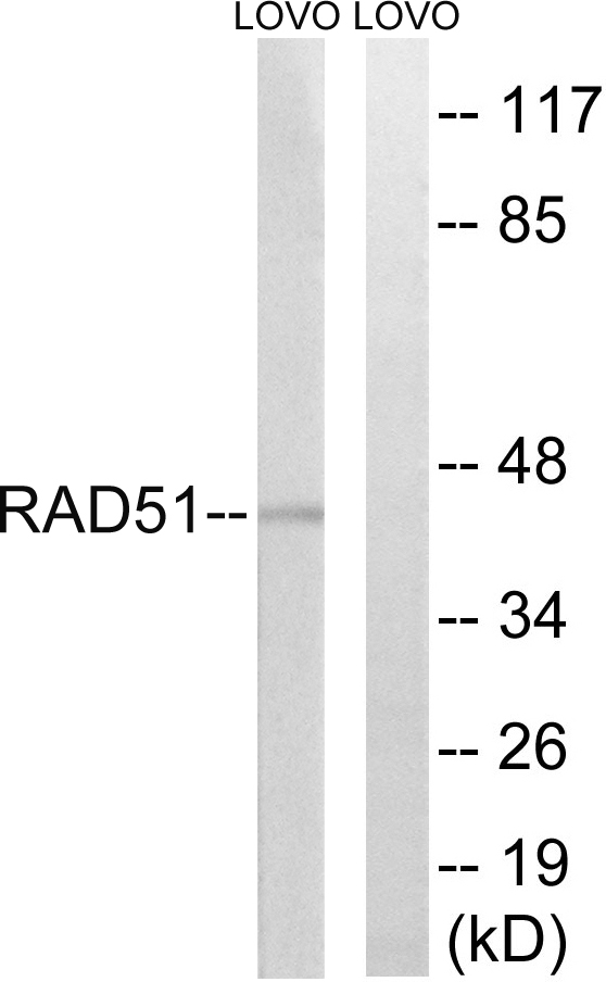 RAD51 Ab