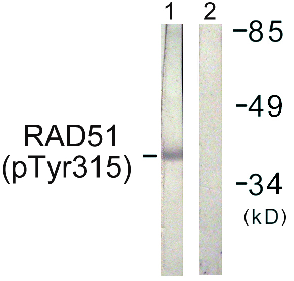 p-RAD51 (Y315) Ab