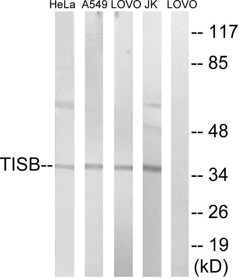 ZFP36L1 Ab