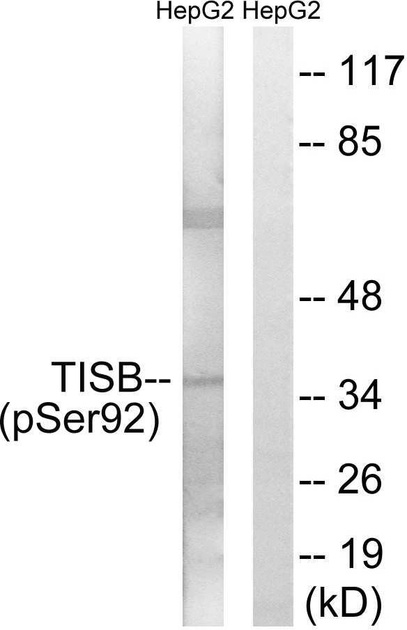 p-ZFP36L1 (S92) Ab