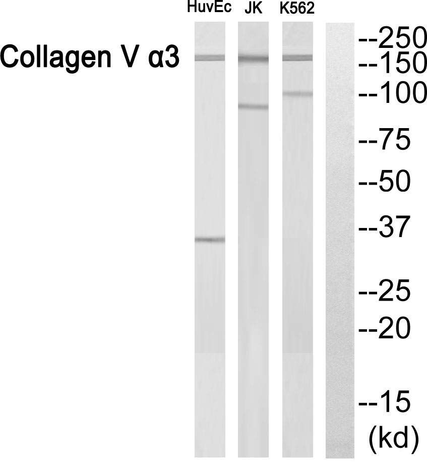 alpha Actinin 3 Ab