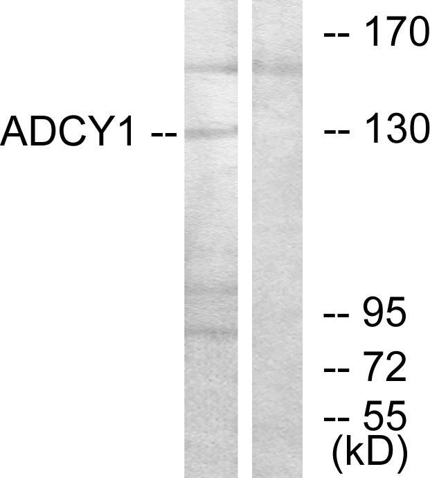 Adenylate cyclase type 1 Ab