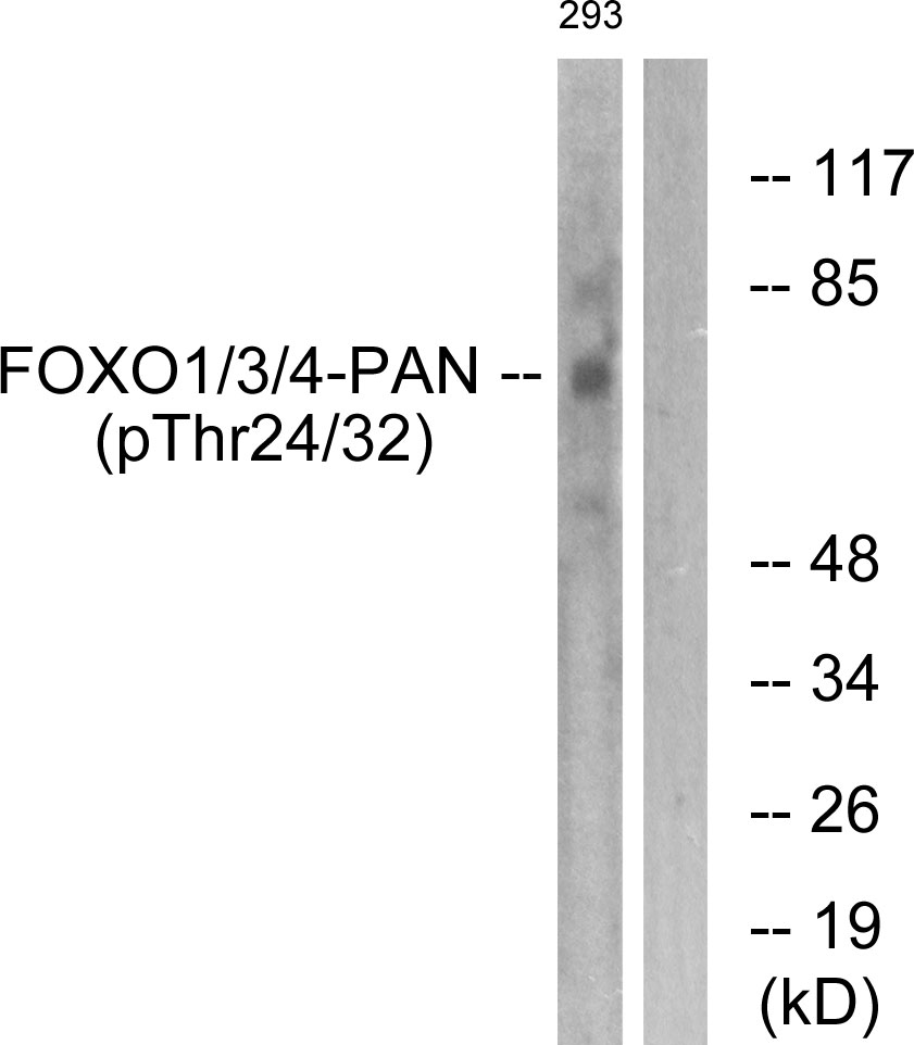 p-FOXO1/3/4 (T24/T32/T32) Ab