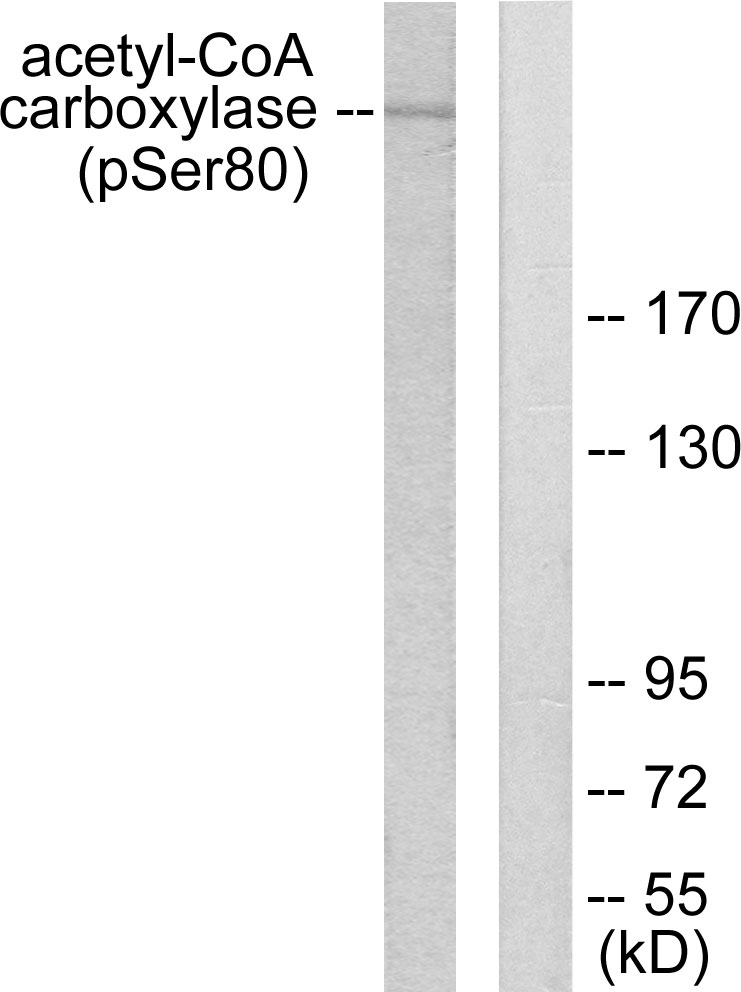 p-Acetyl CoA carboxylase 1 (S80) Ab