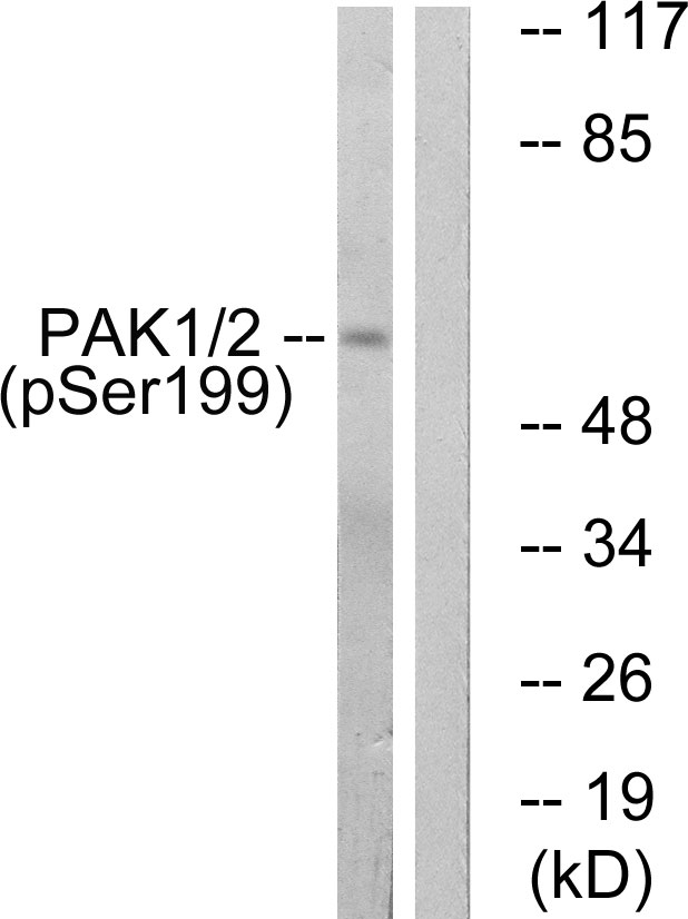 p-PAK1 (S199) Ab