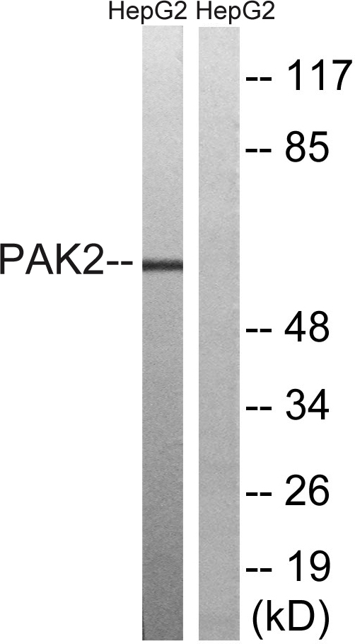 PAK2 Ab