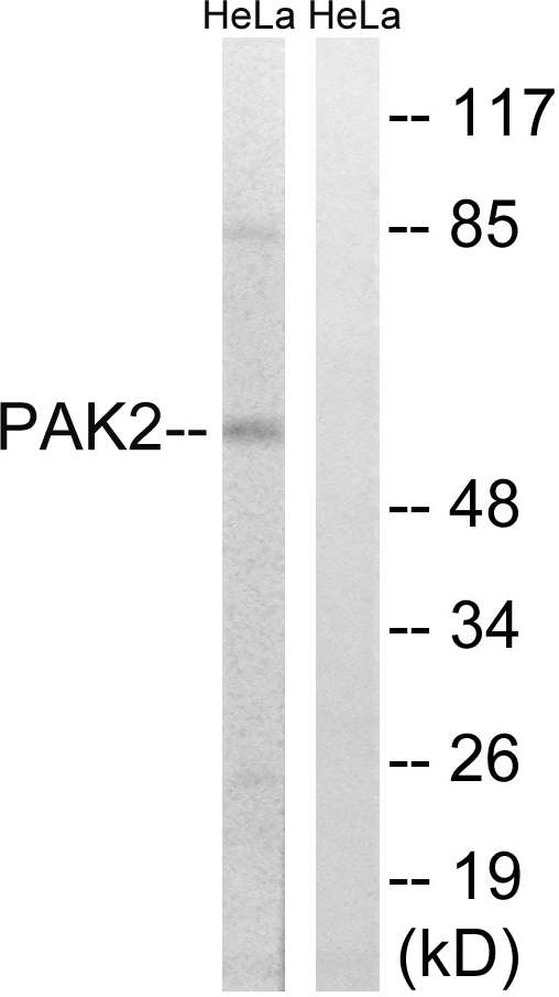 PAK2 Ab