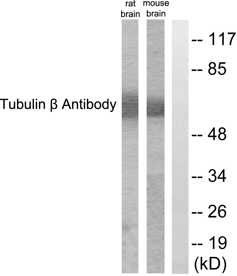 beta III Tubulin Ab