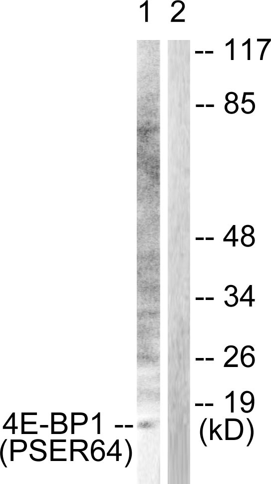 p-4E BP1 (S65) Ab