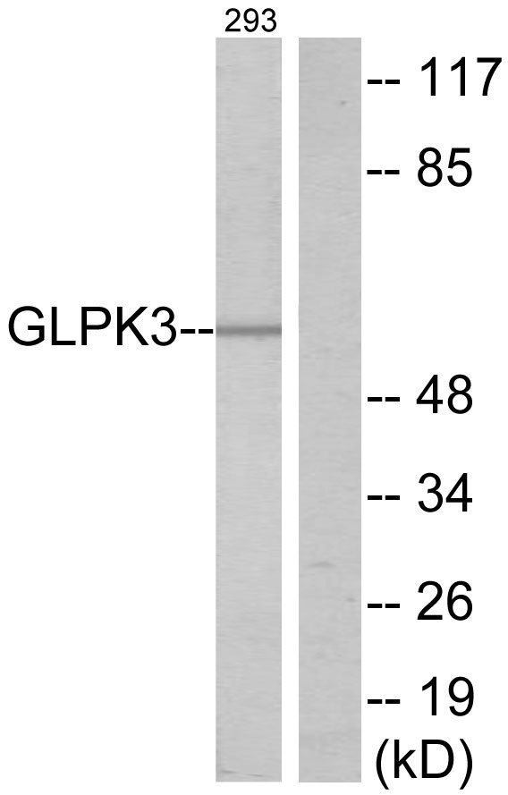 Glycerol kinase Ab