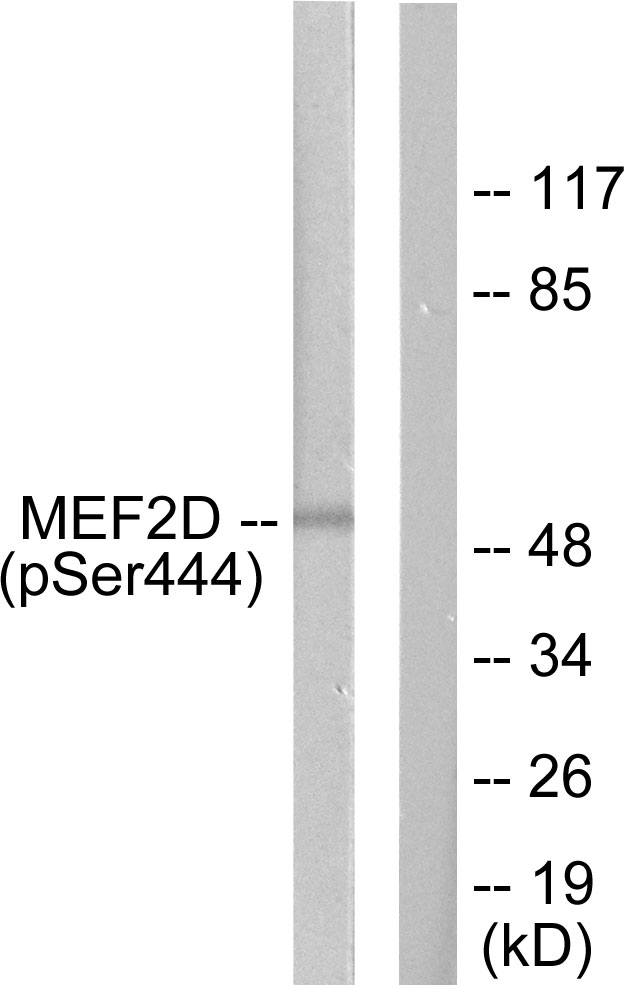 p-MEF2D (S444) Ab