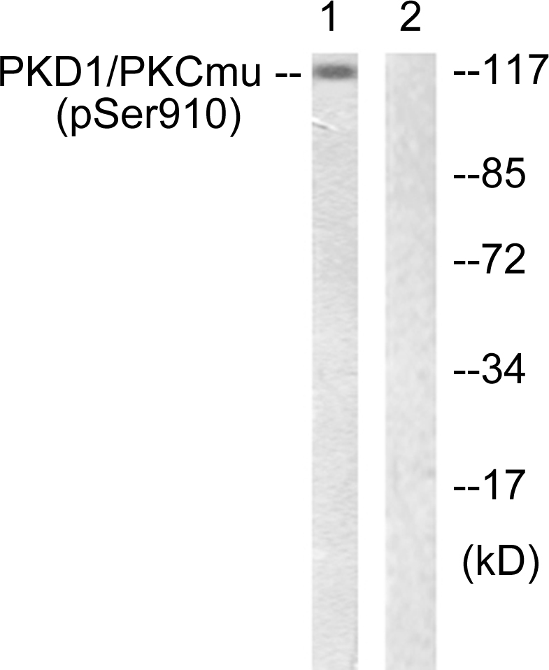 p-PKC mu (S910) Ab