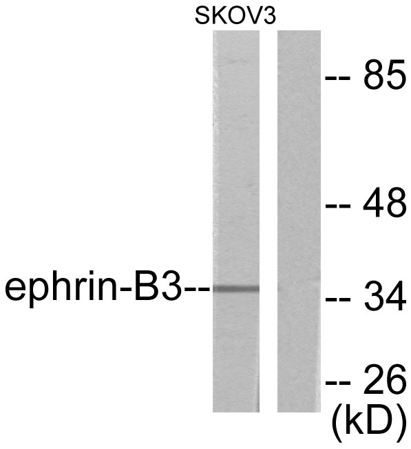 Ephrin B3 Ab