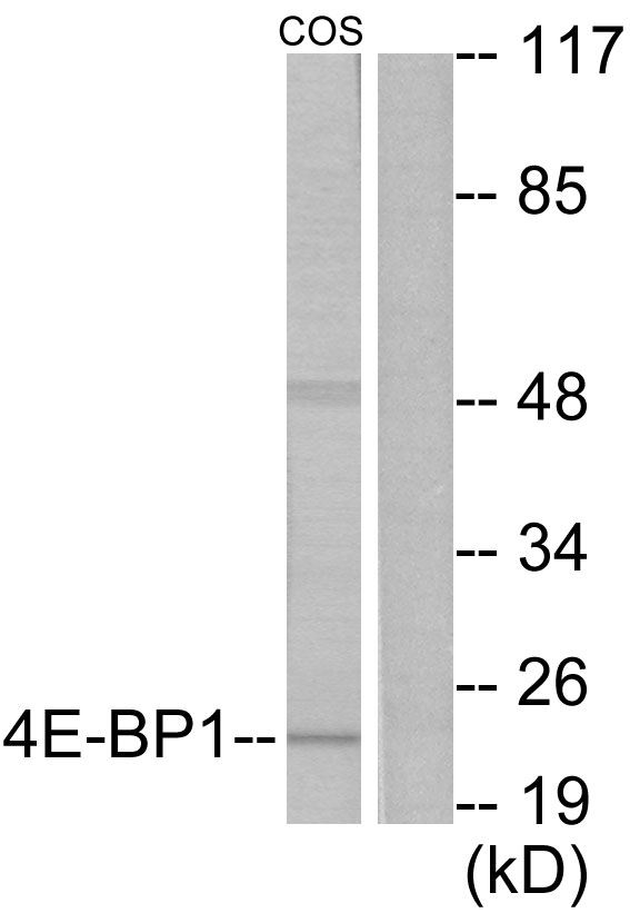 4E BP1 Ab