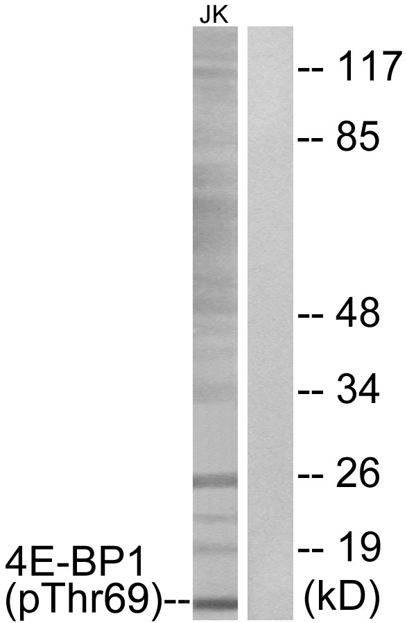p-4E BP1 (T69) Ab