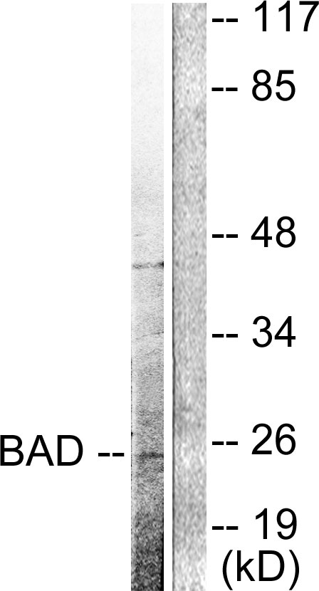 Cleaved-BAD (D71) Ab