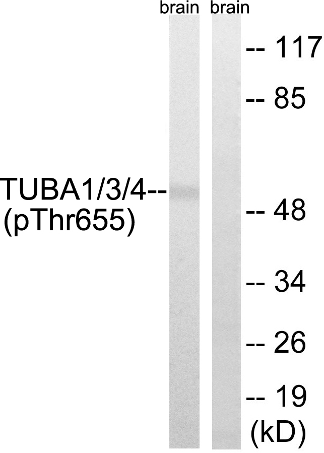 p-alpha 1/3/4 Tubulin (Y272) Ab