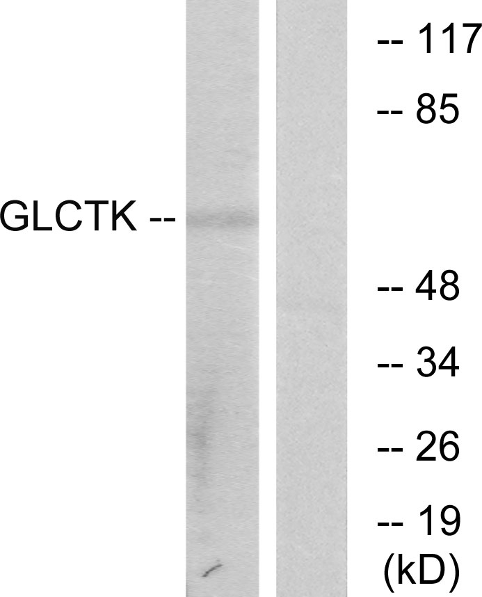 Glycerate kinase Ab