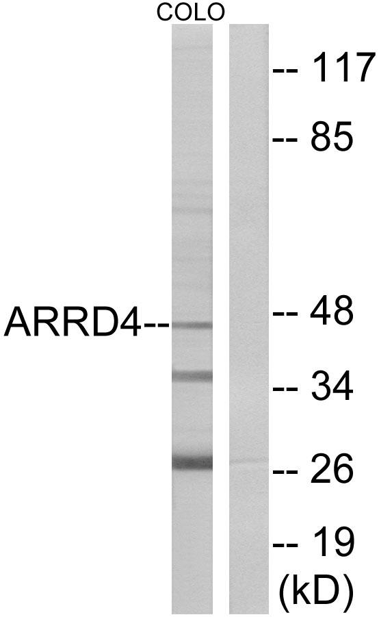 ARRDC4 Ab