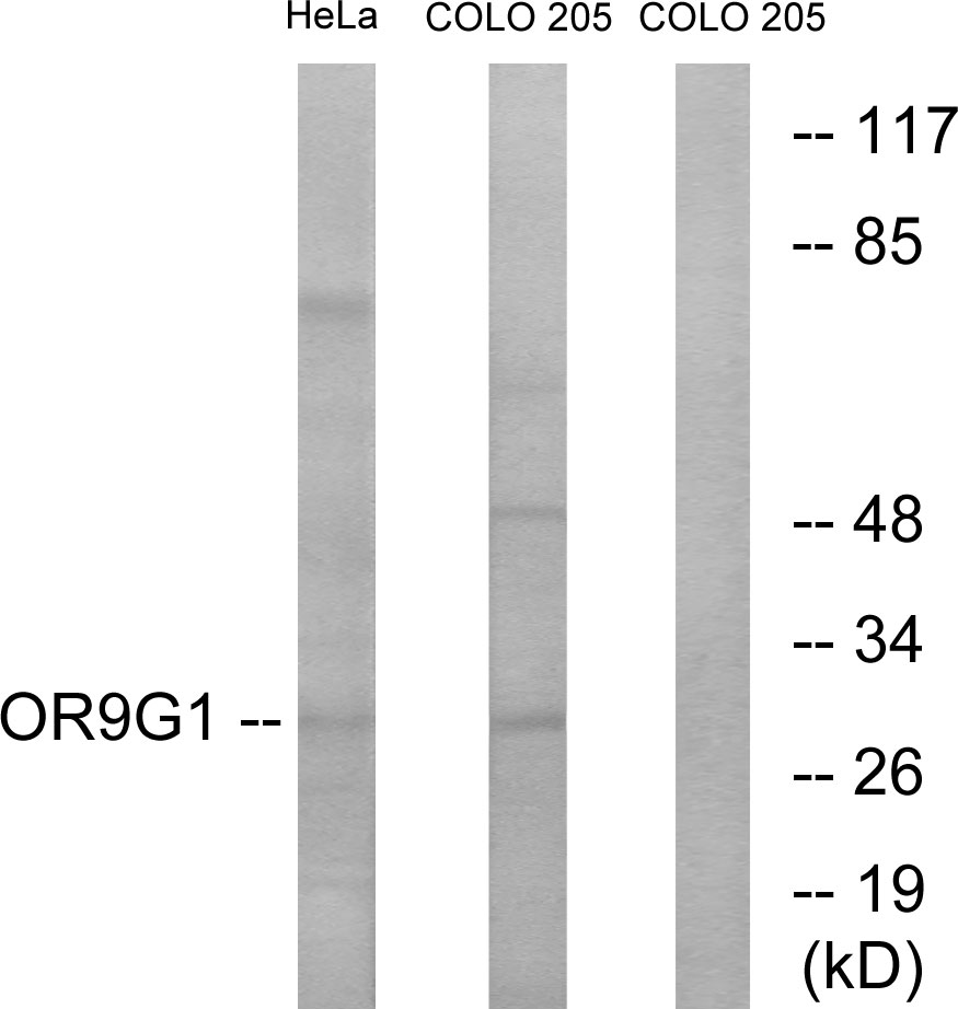 OR9G1/OR11-215 Ab