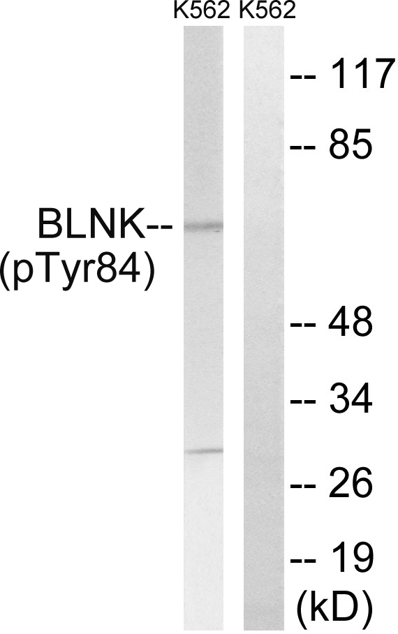 p-BLNK (Y84) Ab