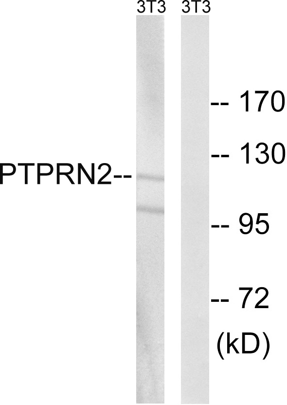 R PTP N2 Ab